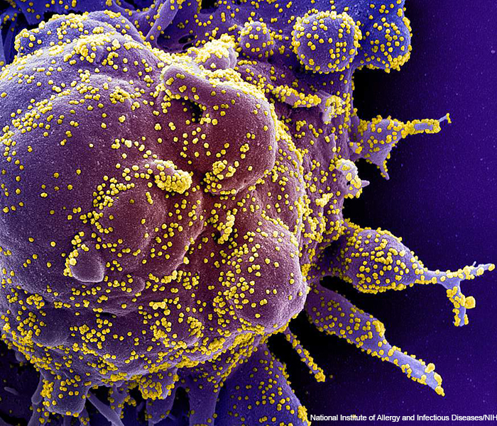 SARS-CV-2-infected cell